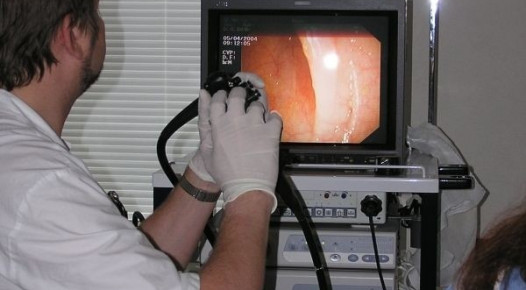 Gastroskopie – optické vyšetření žaludku