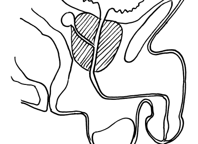 Prostata