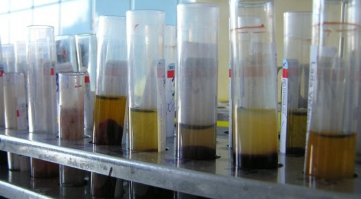 Po odběru se provádí laboratorní vyšetření