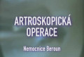 Lékař Vám doporučil artroskopii kolene? Podívejte se, co vás čeká