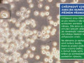 Chřipkový virus: zabiják buněk v přímém přenosu