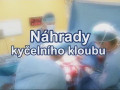 Dosloužil Vám starý kloub? Vyměňte jej!
