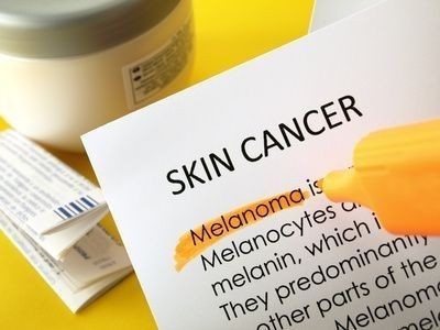 Rakovina kůže