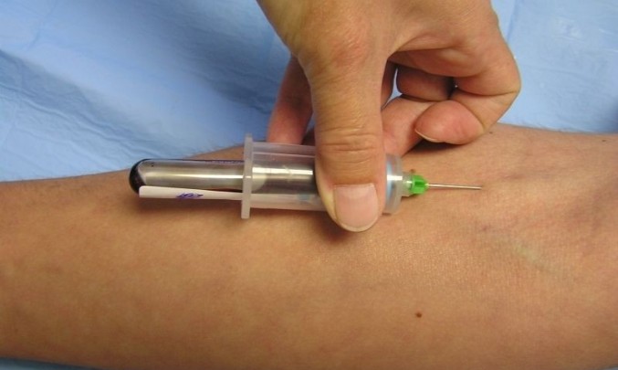 strikacka,injekce,intravenosní aplikace