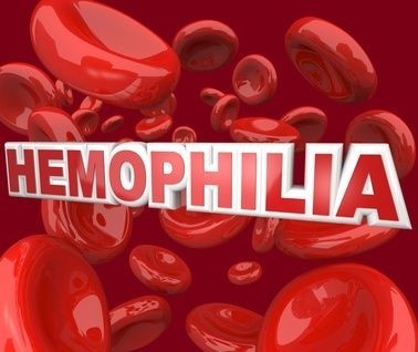 hemofilie