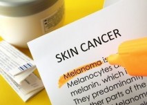 Rakovina kůže