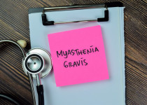 Vše, co potřebujete vědět o léčbě myastenie, a báli jste se zeptat